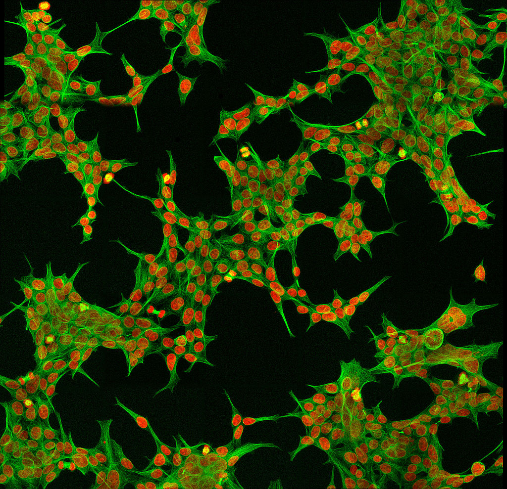 HEK293 cells